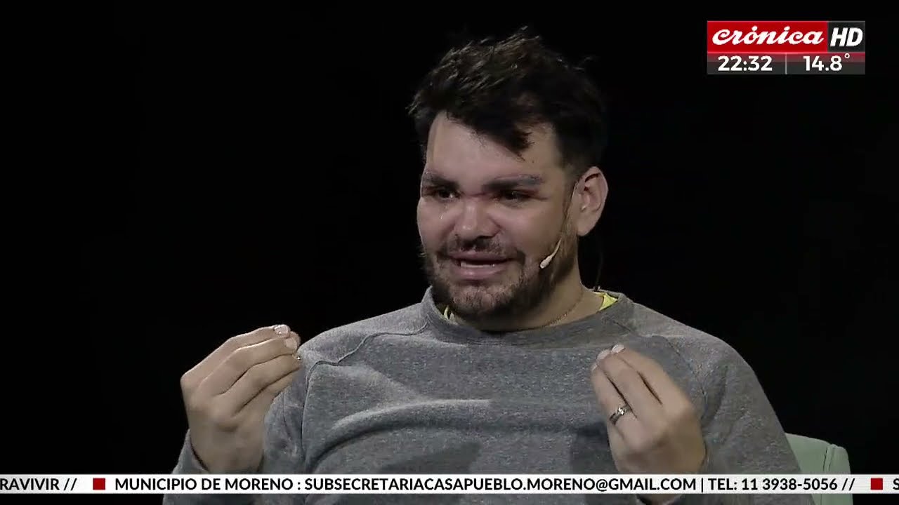 Fran Mariano en Seres Libres: No quiero operarme pero no puedo parar de hacerlo