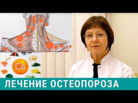 Остеопороз - что это? Симптомы и лечение остеопороза. Нутрицевтики