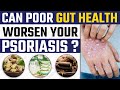 Is Leaky Gut Responsible For Psoriasis? | Dr. Health | Dr. Megha Chaturvedi