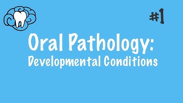Oral Pathology | Developmental Conditions | INBDE, ADAT