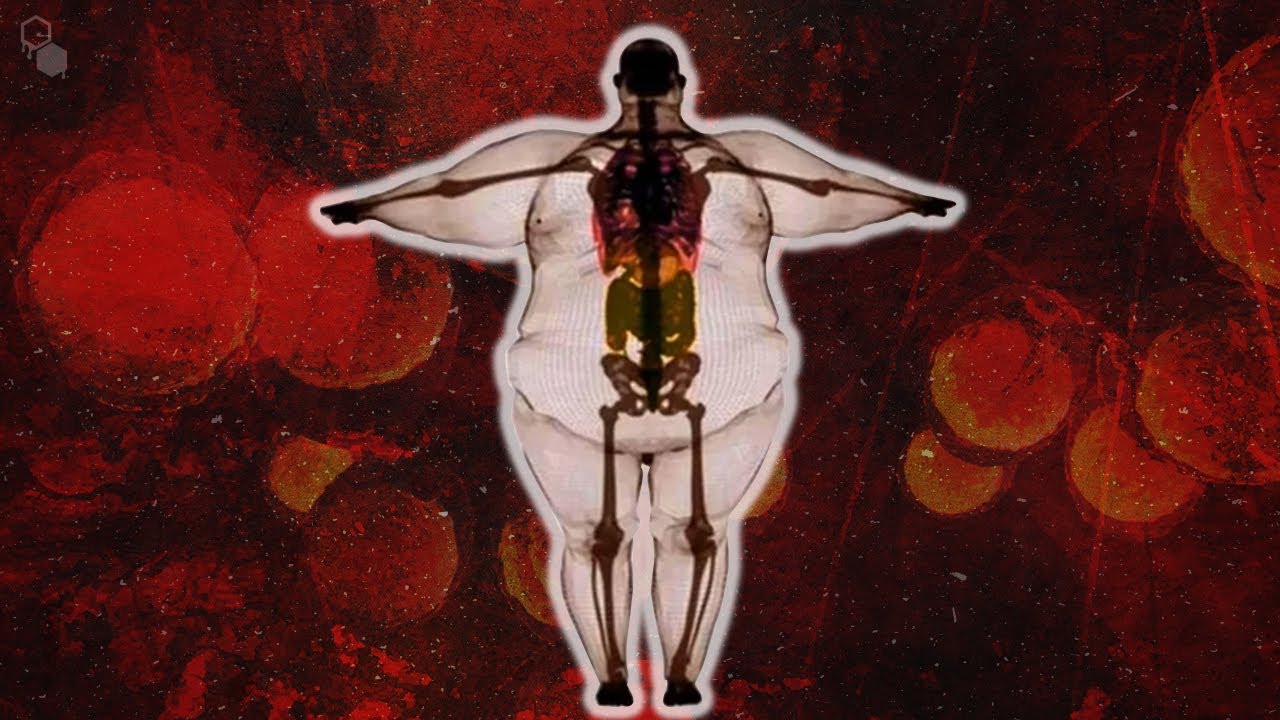 Что ожирение делает с вашим телом