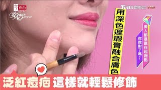 完美遮瑕術:先全臉提亮,再用這招修飾泛紅痘疤!女人我最大 20171128