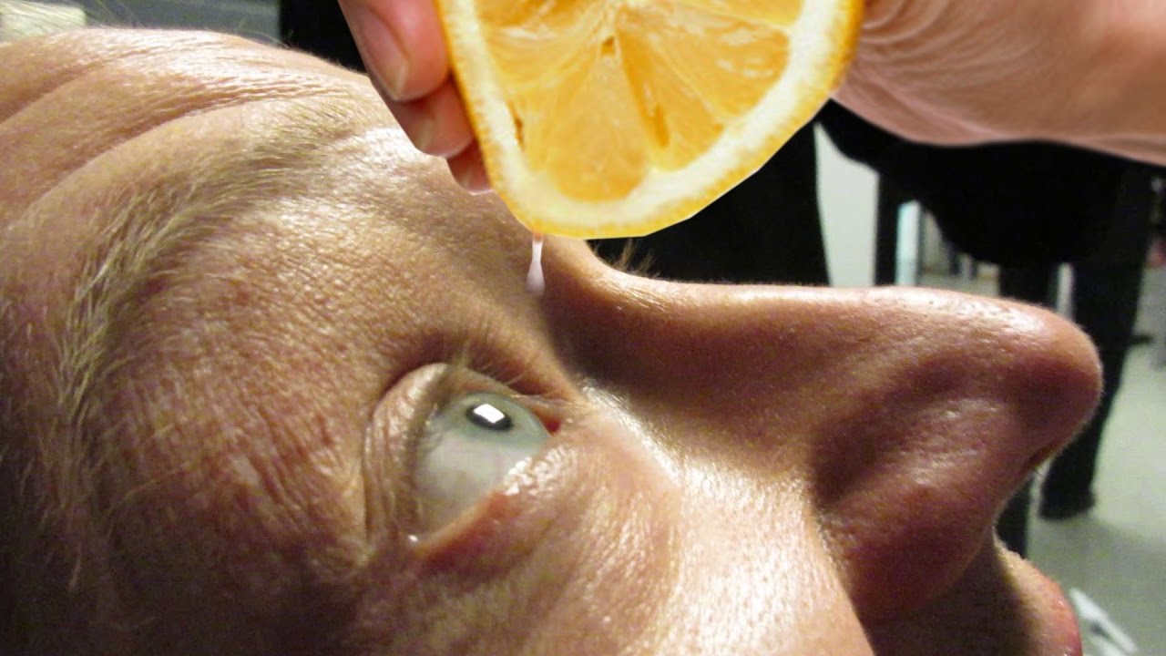 Почему давят глаза и виски. Лимон с глазами. Выдавить лимон.