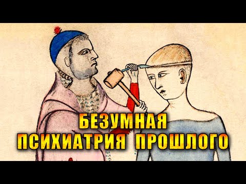 Дырка в черепе, компресс из мозгов, утопление. Как раньше лечила психиатрия