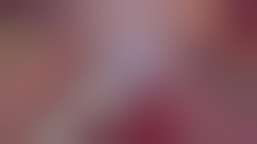 Step by step laparoscopic left lateral sectionectomy