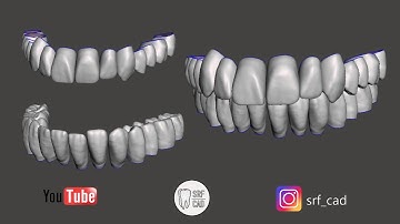 MESHMIXER DENTAL : Come caricare una libreria dentale Tooth library  jaw maxillary lower upper