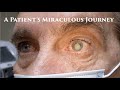 A patients miraculous journey  baseball injury  cataract surgery  ode to ophthalmology dr krad