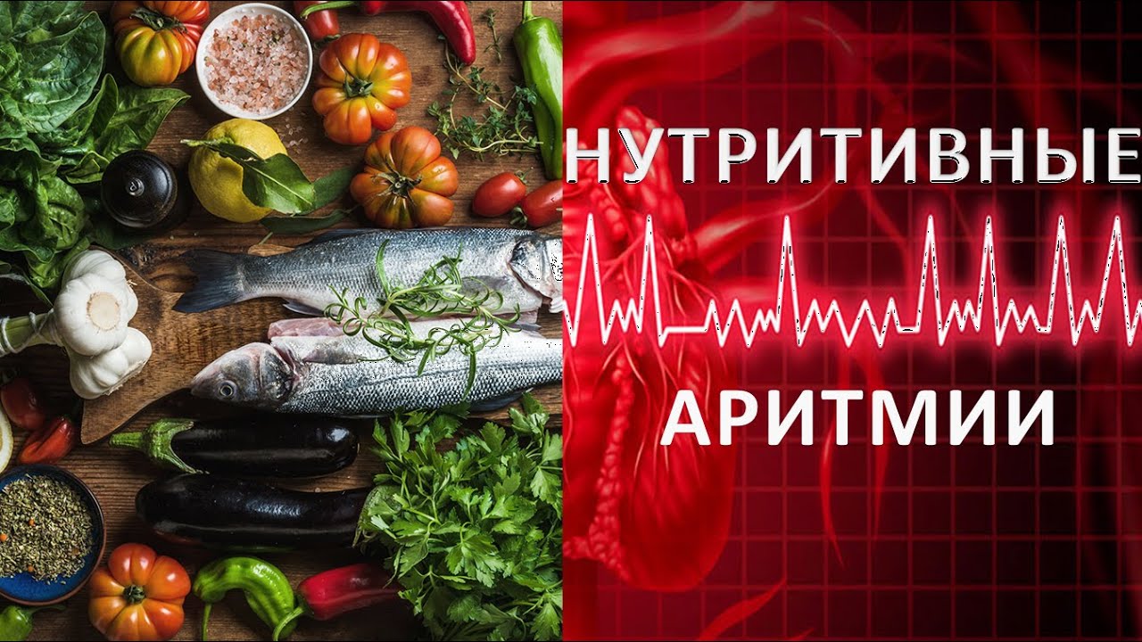 НУТРИТИВНЫЕ АРИТМИИ: продукты питания и нарушения сердечного ритма