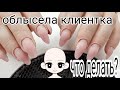 Жесткая Жесть/Лысая клиентка/Связанно ли наращивание ногтей и облысение/Шулунова Дарья