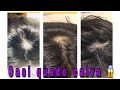 Casi Quedó Calva 😱adiós Caída Del Cabello/Tips De Crecimiento ❤️