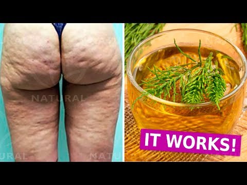 How to Get Rid of Cellulite Naturally