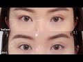 HOW I FIX MY UNEVEN EYELIDS NATURALLY 👀✨