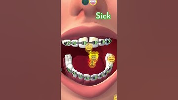 🐹Perfect Smile 3D Max All Levels Game Android iOS Gameplay Walkthrough #15 #Shorts