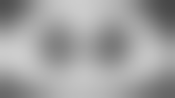 uniportal VATS right S1 and S2 anatomical segmentectomy