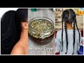 Use This Herbal Oil For Massive Thicker Hair | Reverse Alopecia Block DHT Stop Thinning & Baldness
