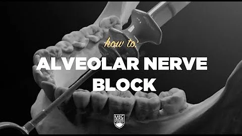 How To - Alveolar Nerve Block #ubcmedicine #ubcdentistry