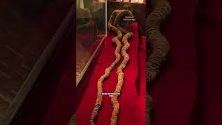 The Skull With 2.8 Meters of Hair