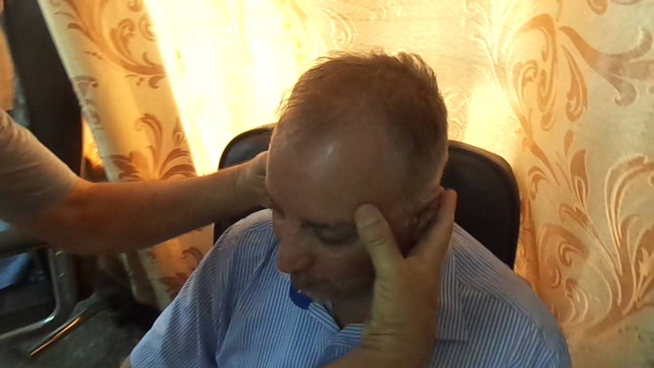 علاج داء الشقيقة