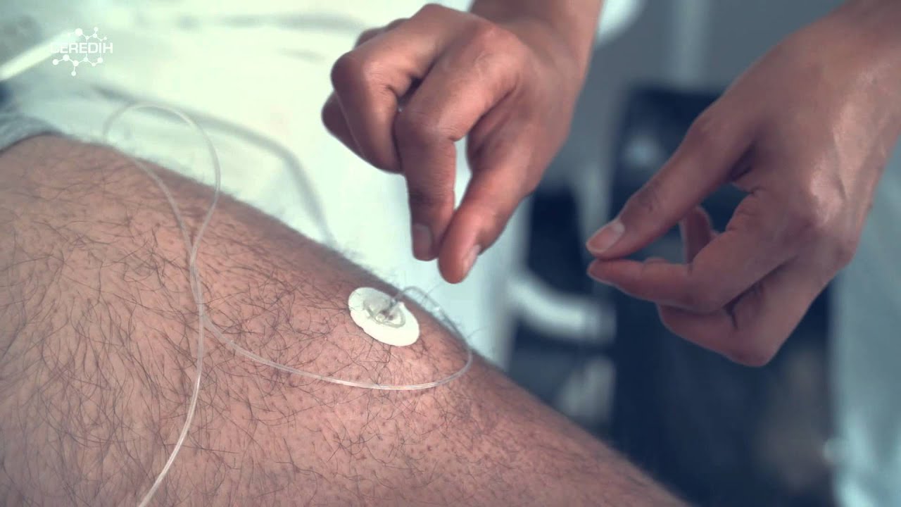 Film dédié à la substitution par immunoglobulines à domicile des DIH - IRIS Film dédié à la substitution par immunoglobulines à domicile des DIH - IRIS