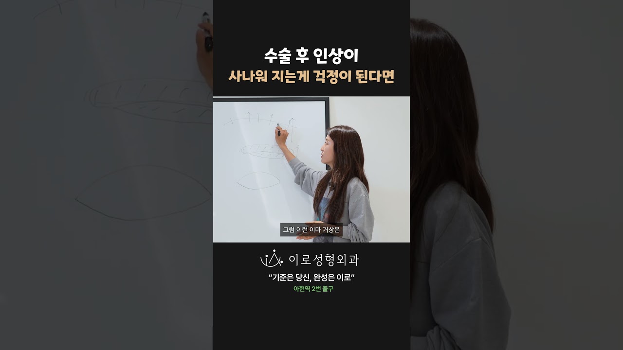 눈수술 후 인상이 사나워지는 게 걱정이라면