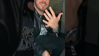 Magician grows an extra finger with this magic trick 😨