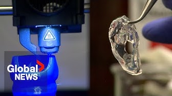 Thumbnail for “Game changer”: 3D-printing breakthrough could transform chronic lung disease