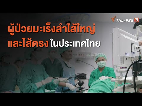 ผู้ป่วยมะเร็งลำไส้ใหญ่และไส้ตรงในประเทศไทย : จับตาข่าวเด่น (31 ส.ค. 63)