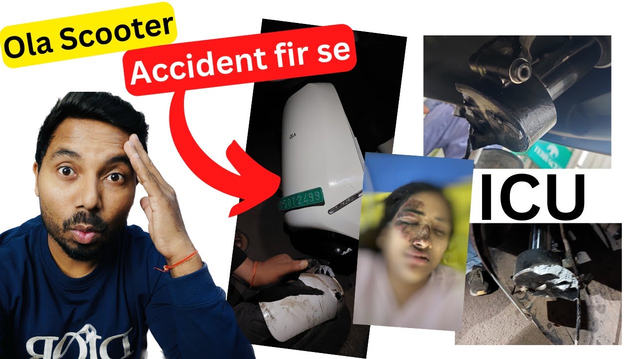 Another Ola S1 front wheel breaks, rider in ICU for serious head