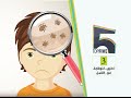 توب 5 | الوقاية من القمل | الموسم الثاني