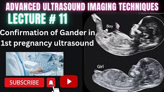 Gender Identification Male or Female | ultrasound scaning technique #ultrasound #technology