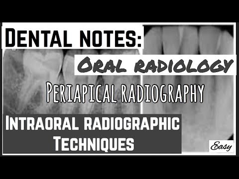Wideo: Dlaczego wykonuje się radiogramy okołowierzchołkowe?