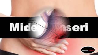 Mide Kanseri