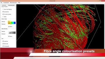 Myocardial fibers reconstruction