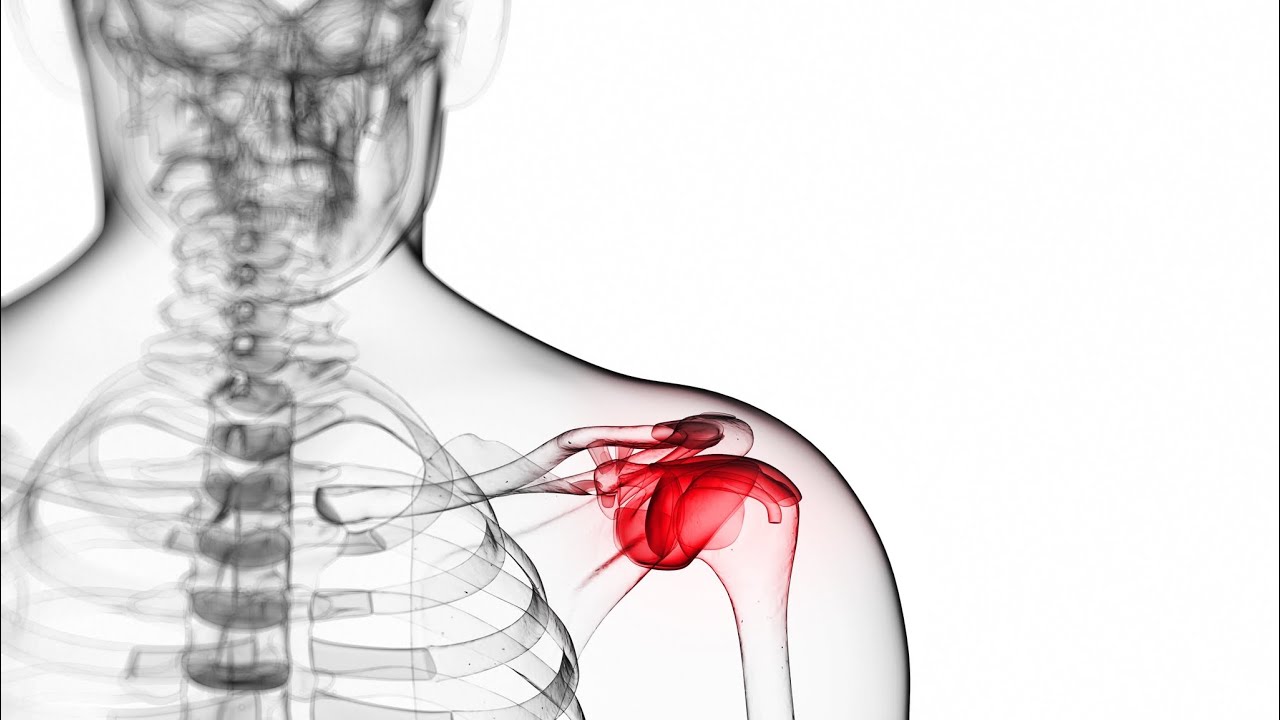 Болит правое плечо отдает в шею. Сильная боль в области ключицы.