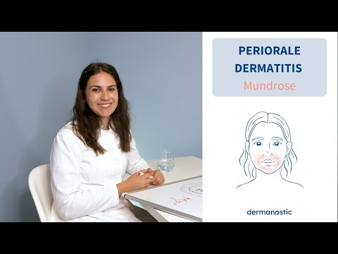 Video: Periorale Dermatitis - Behandeling, Dieet, Oorzaken