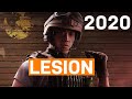 How to Play Lesion (Soccer Dad) 2020