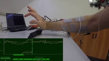 A neuroprosthesis for restoring paralyzed hand functions using FES -- Part II