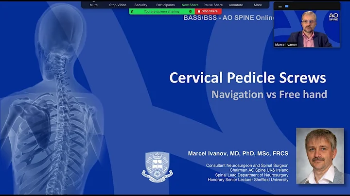 The Great Debate Cervical Pedicle Screws Navigation vs Free hand.