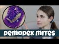 DEMODEX MITES ON YOUR SKIN| DR DRAY