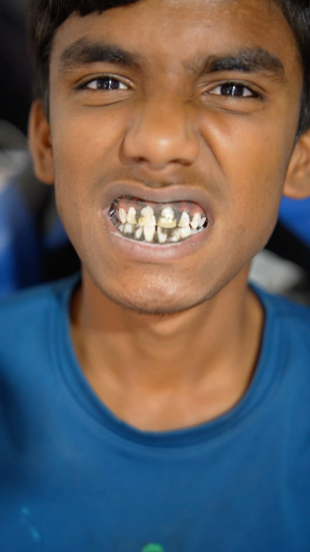 CHOTU KA DIRTY TEETH #shorts @FACTFIREKING