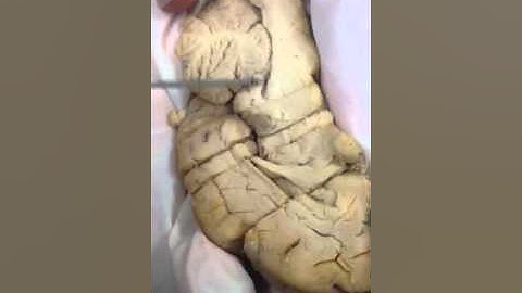 Complete sheep brain anatomy