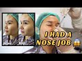 I HAD A NOSE JOB | Jen Barangan