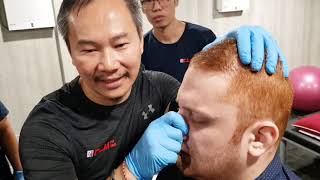 Yr 2019 Nose Misalignment done by Chris Leong | How to TOP 3 Mos | MostAmazingTop10 马来西亚吉隆坡 Malaysia