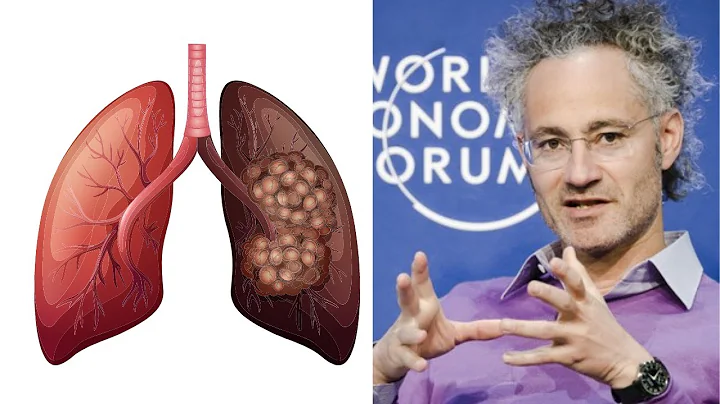Palantir Is Helping People With Cancer