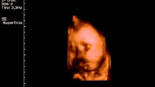 Mi Baby Chupandose La Mano