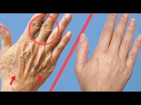 Видео: Как избавиться от пятен с рук