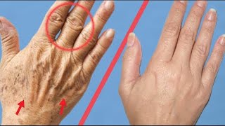 Как сделать Ваши Руки Моложе На 5 Лет | Удалить Пигментные Пятна С Ваших Рук