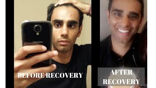 How recovery from Anxiety and Panic Attacks ACTUALLY looks like (and how to FULLY recover)