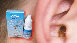 Download lagu Informasi Obat tetes telinga Vital Ear Oil untuk mengatasi kotoran telinga dan sebagai antiseptik