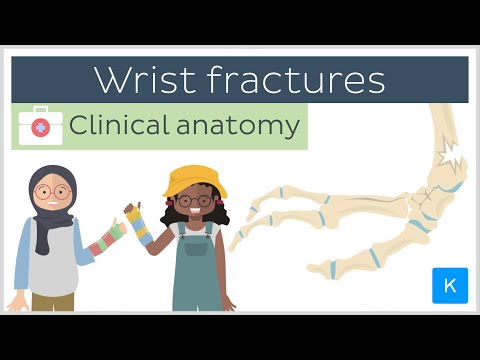Forearm fractures: Wrist fractures - Clinical Anatomy | Kenhub